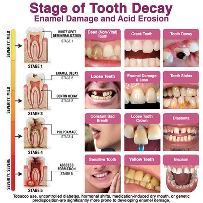 🇺🇸 Official Store | ✨ Trilumia® DenPerm🦷 Cavity-Repair Natural Enamel Filling Gel